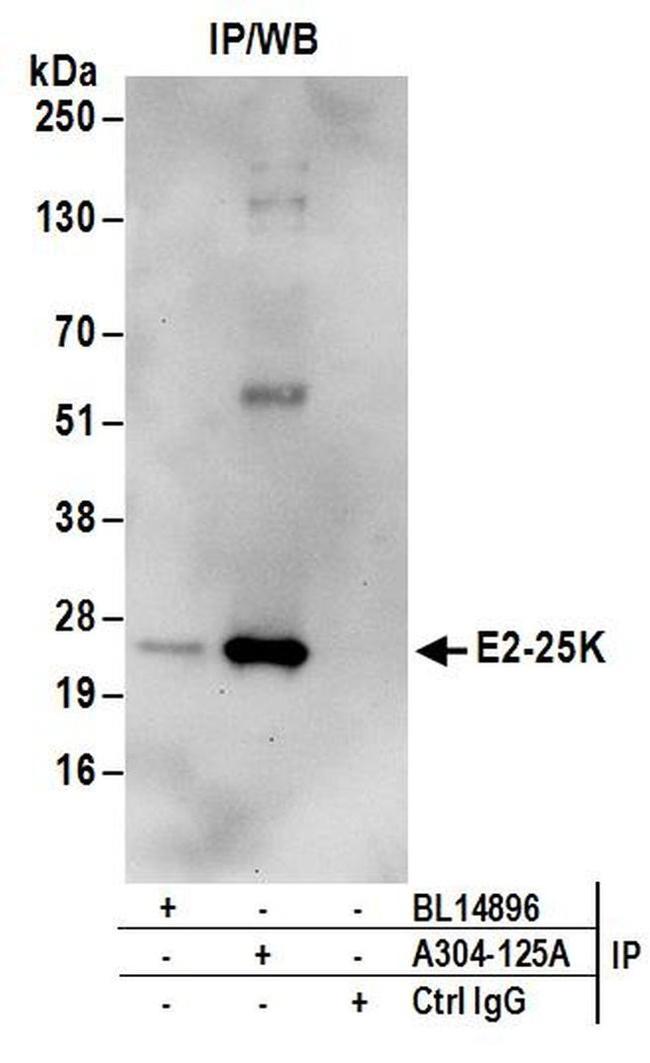 E2-25K Antibody in Western Blot (WB)