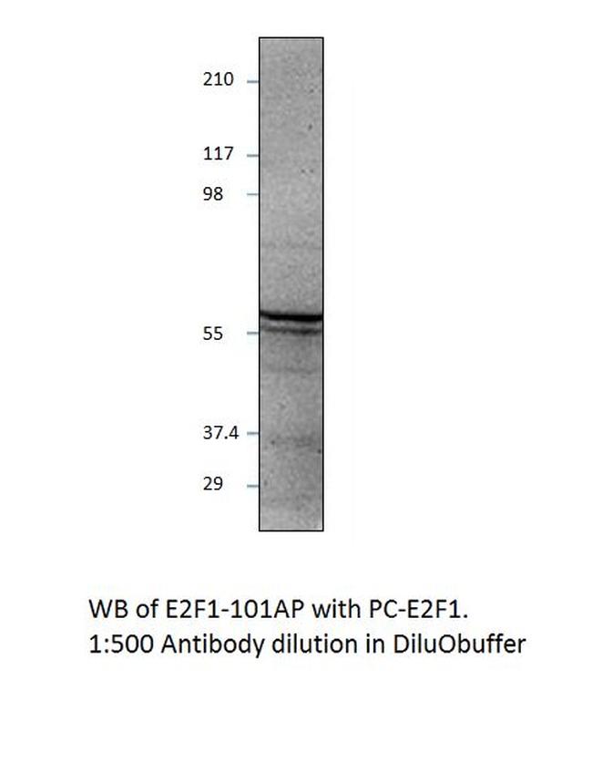 E2F1 Antibody in Western Blot (WB)