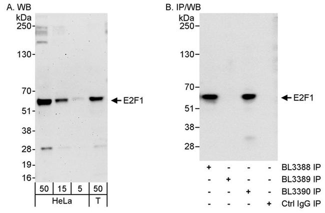 E2F1 Antibody in Western Blot (WB)