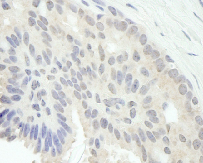 E2F1 Antibody in Immunohistochemistry (IHC)