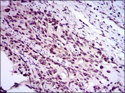 E2F1 Antibody in Immunohistochemistry (Paraffin) (IHC (P))