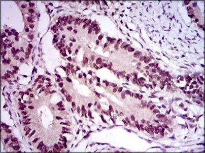 E2F1 Antibody in Immunohistochemistry (Paraffin) (IHC (P))