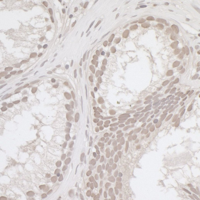 E2F4 Antibody in Immunohistochemistry (IHC)