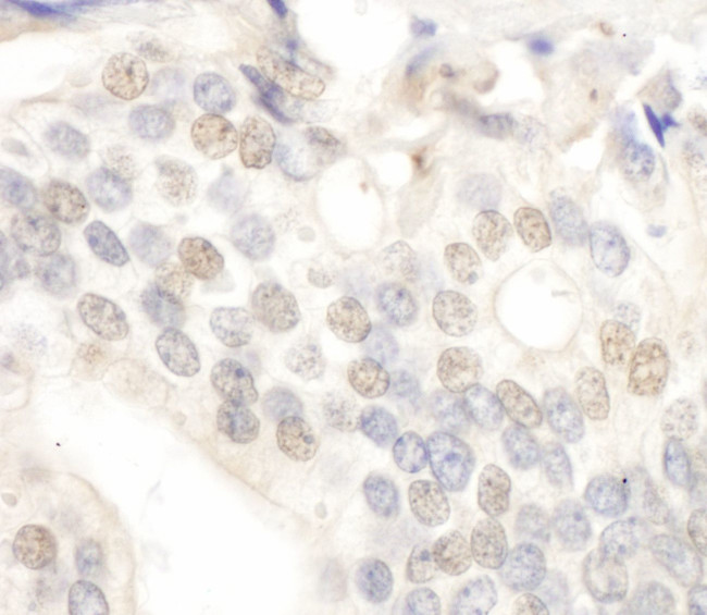 E2F4 Antibody in Immunohistochemistry (IHC)