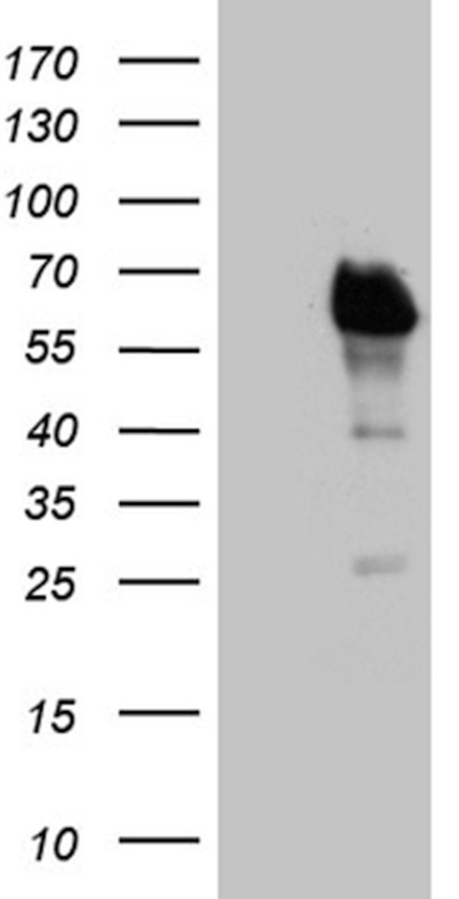 E2F4 Antibody in Western Blot (WB)