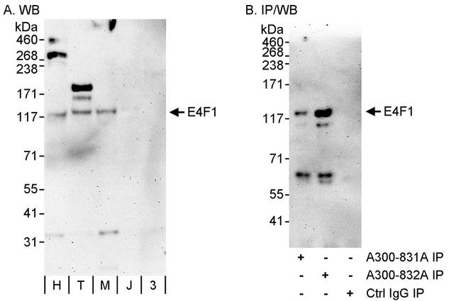 E4F1 Antibody in Western Blot (WB)