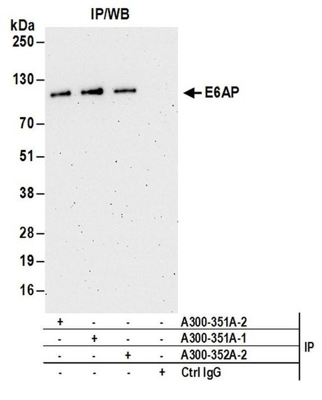 E6AP Antibody in Western Blot (WB)