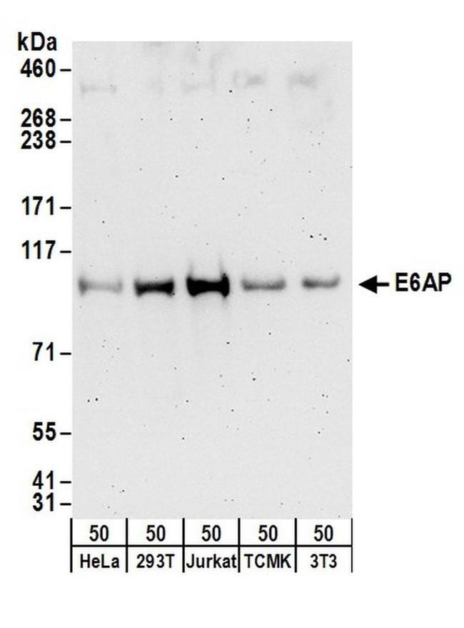 E6AP Antibody in Western Blot (WB)