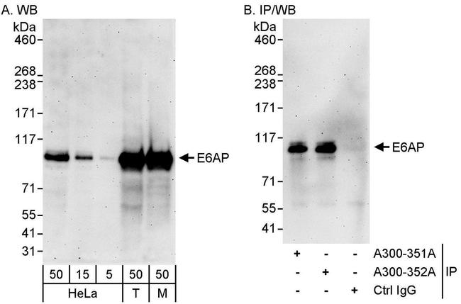 E6AP Antibody in Western Blot (WB)