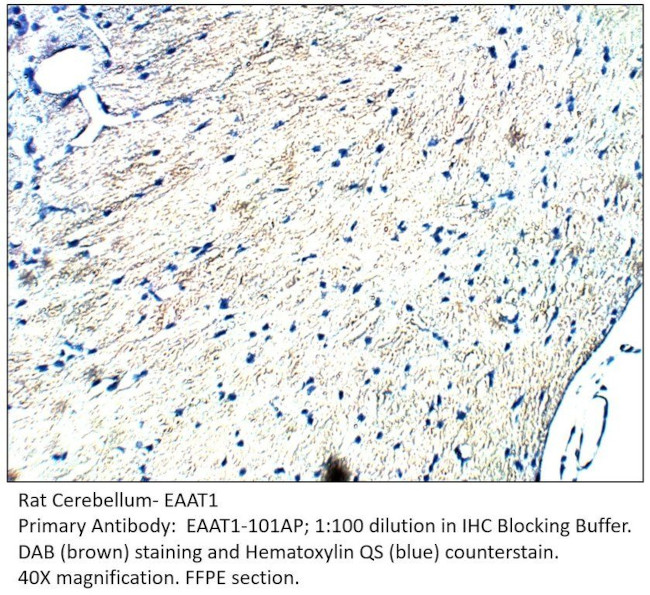 EAAT1 Antibody in Immunohistochemistry (IHC)