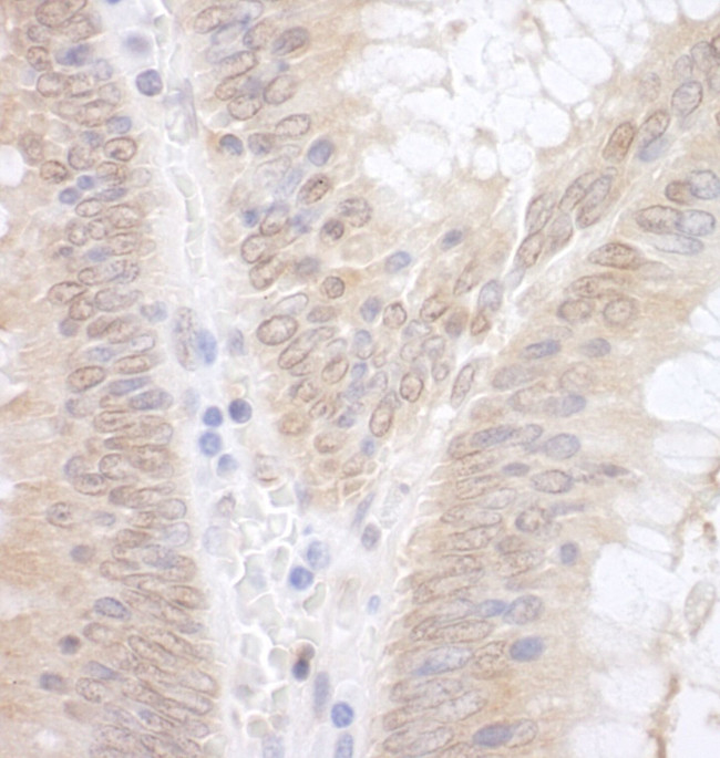 EAF2 Antibody in Immunohistochemistry (IHC)