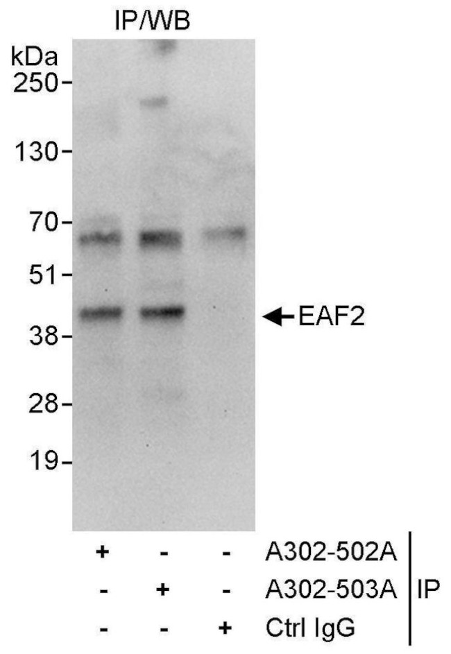 EAF2 Antibody in Immunoprecipitation (IP)