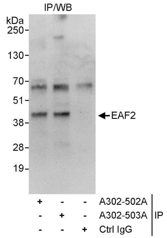 EAF2 Antibody in Immunoprecipitation (IP)