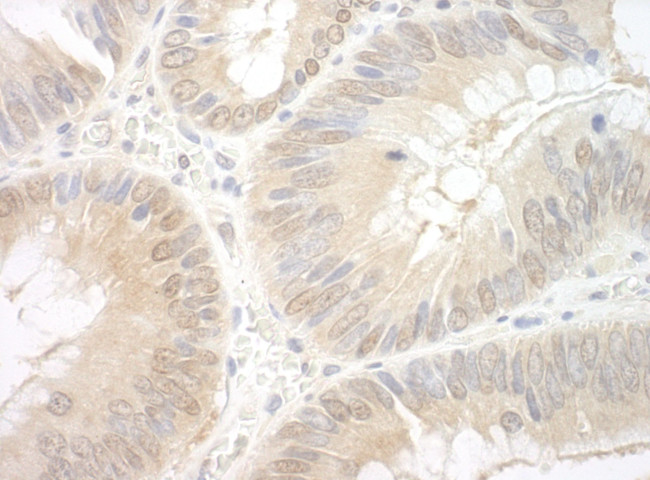 EAF2 Antibody in Immunohistochemistry (IHC)