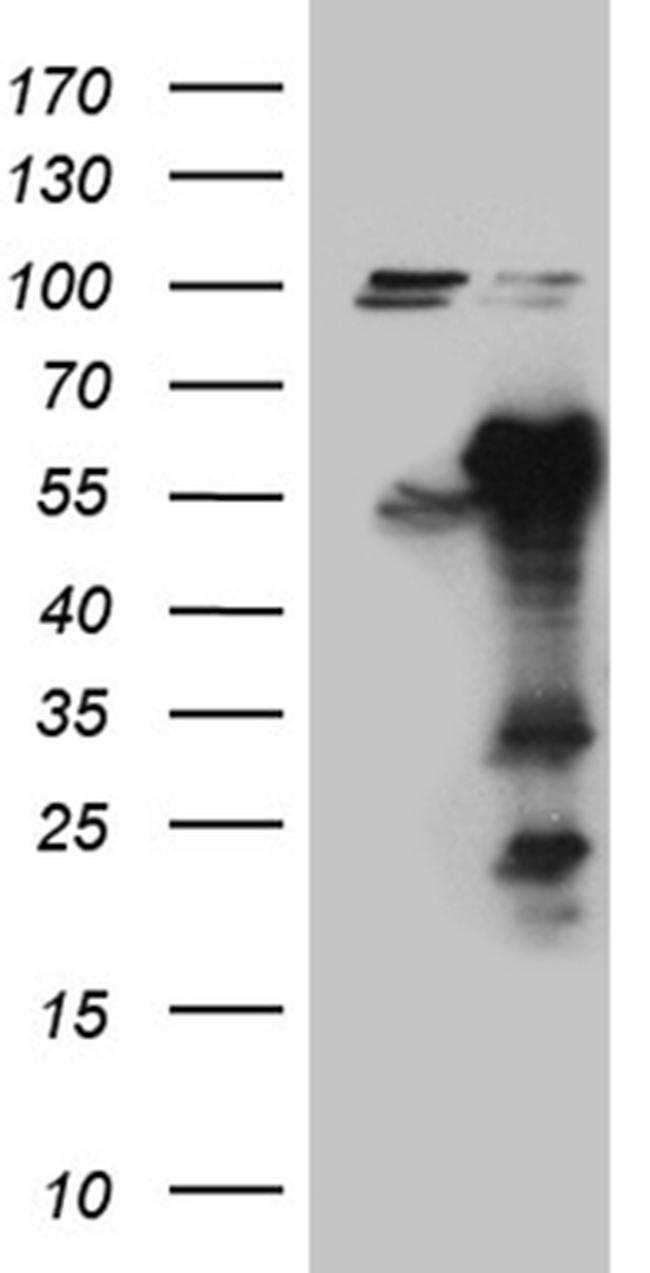 EARS2 Antibody in Western Blot (WB)
