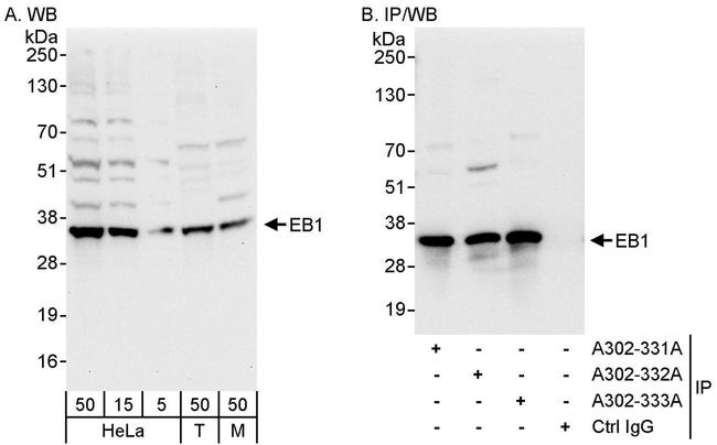 EB1 Antibody in Western Blot (WB)