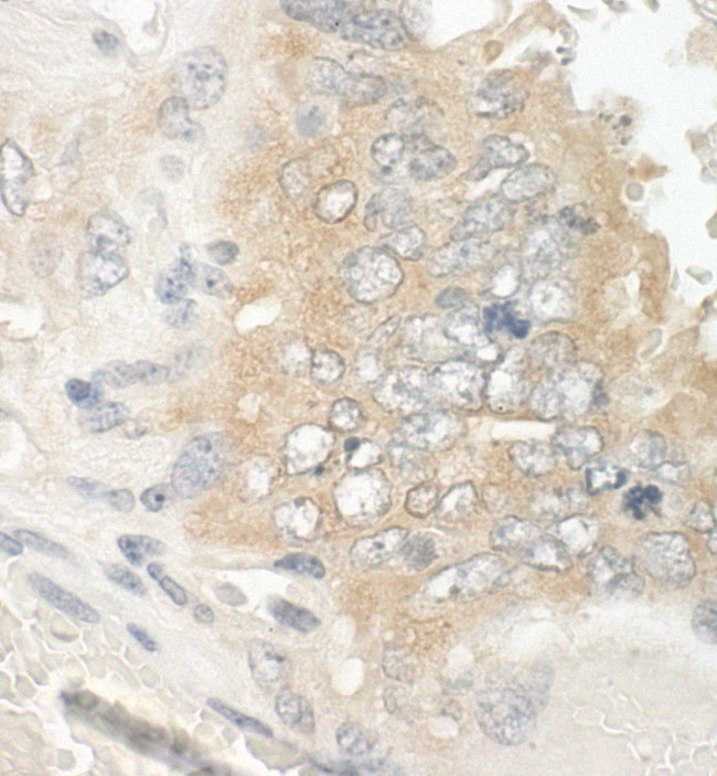 EB1 Antibody in Immunohistochemistry (IHC)