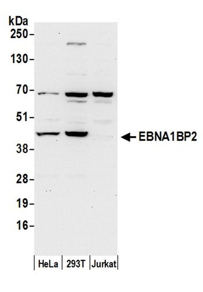 EBNA1BP2/EBNA1 Binding Protein 2/EBP2 Antibody in Western Blot (WB)