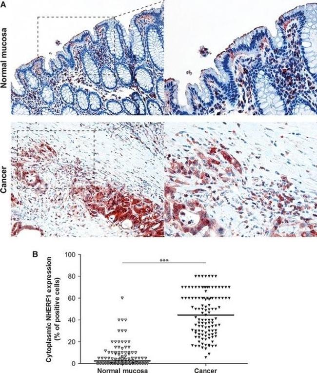 EBP50 Antibody in Immunohistochemistry (Paraffin) (IHC (P))