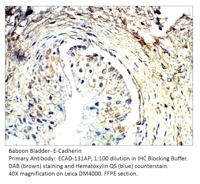 E-Cadherin Antibody in Immunohistochemistry (IHC)