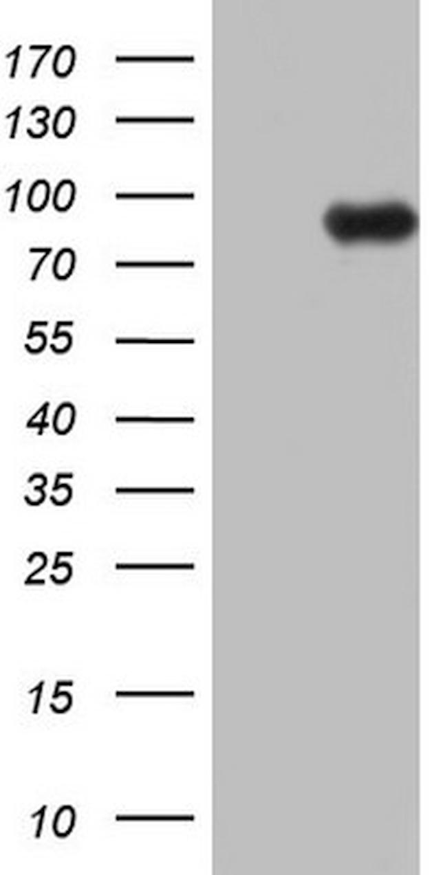 ECE1 Antibody in Western Blot (WB)