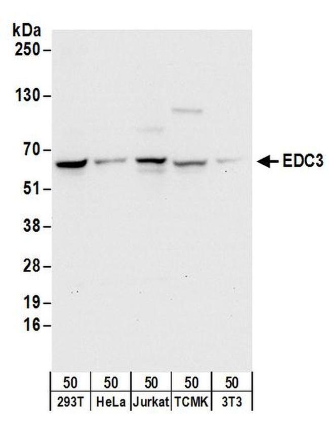 EDC3 Antibody in Western Blot (WB)