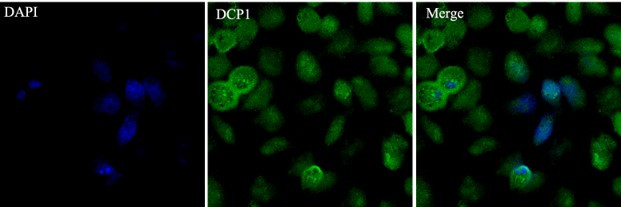 Rabbit IgG (H+L) Highly Cross-Adsorbed Secondary Antibody in Immunocytochemistry (ICC/IF)