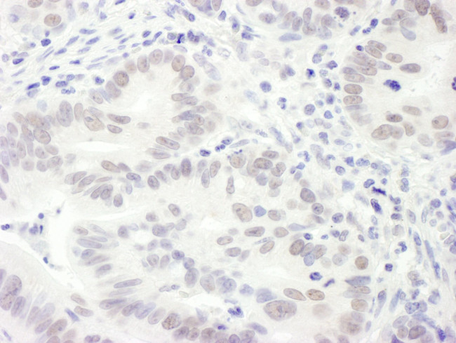 EDD1 Antibody in Immunohistochemistry (IHC)