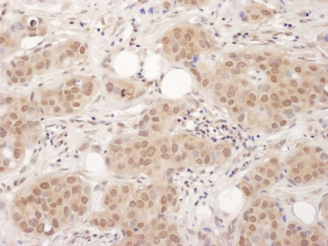 EDF-1 Antibody in Immunohistochemistry (IHC)