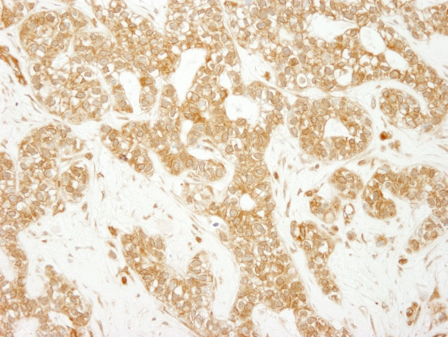 EEA1 Antibody in Immunohistochemistry (IHC)