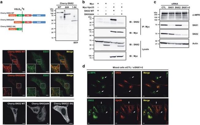 EEA1 Antibody in Immunocytochemistry (ICC/IF)