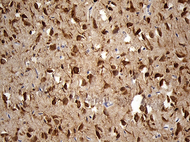 EEF1D Antibody in Immunohistochemistry (Paraffin) (IHC (P))