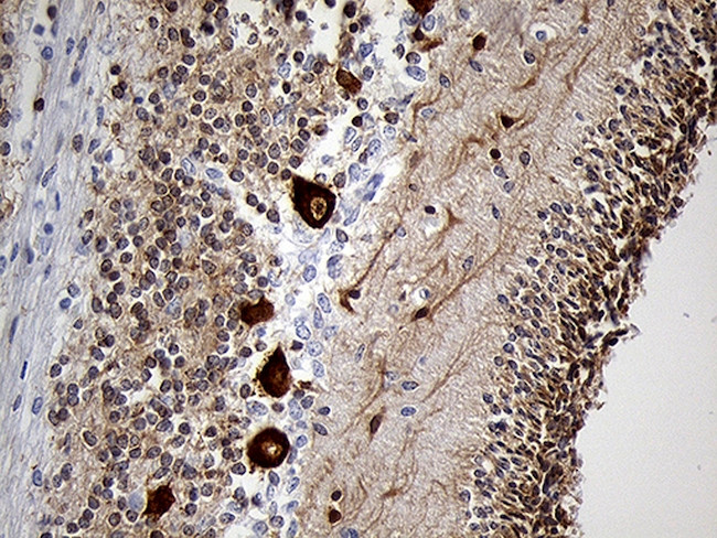 EEF1D Antibody in Immunohistochemistry (Paraffin) (IHC (P))