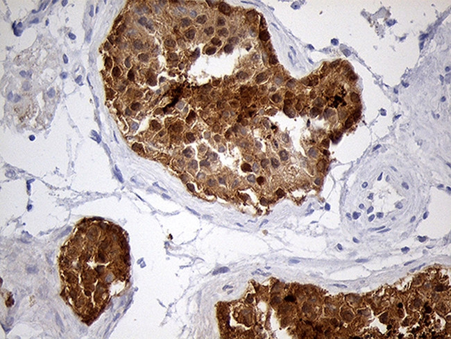 EEF1D Antibody in Immunohistochemistry (Paraffin) (IHC (P))