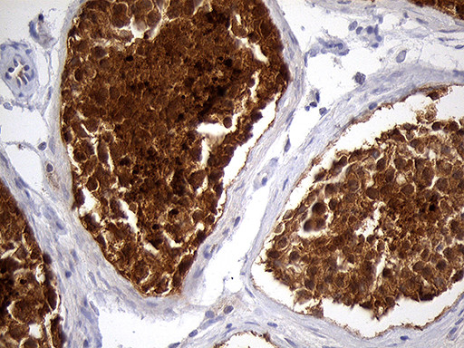 EEF1D Antibody in Immunohistochemistry (Paraffin) (IHC (P))