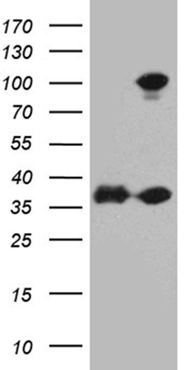 EEF1D Antibody in Western Blot (WB)