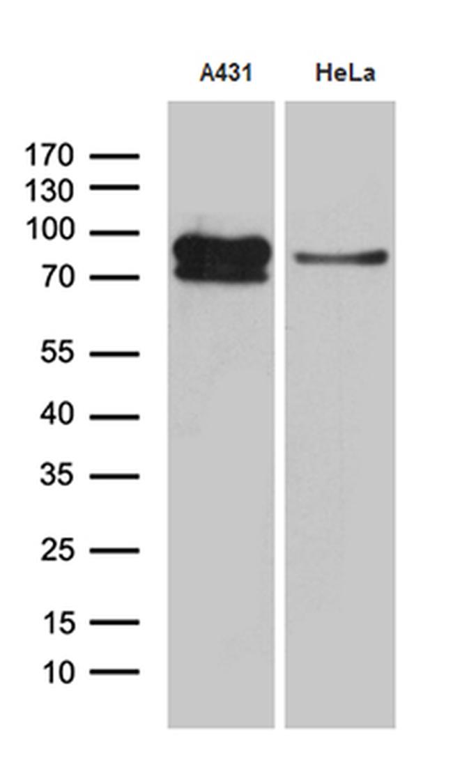 EEF1D Antibody in Western Blot (WB)