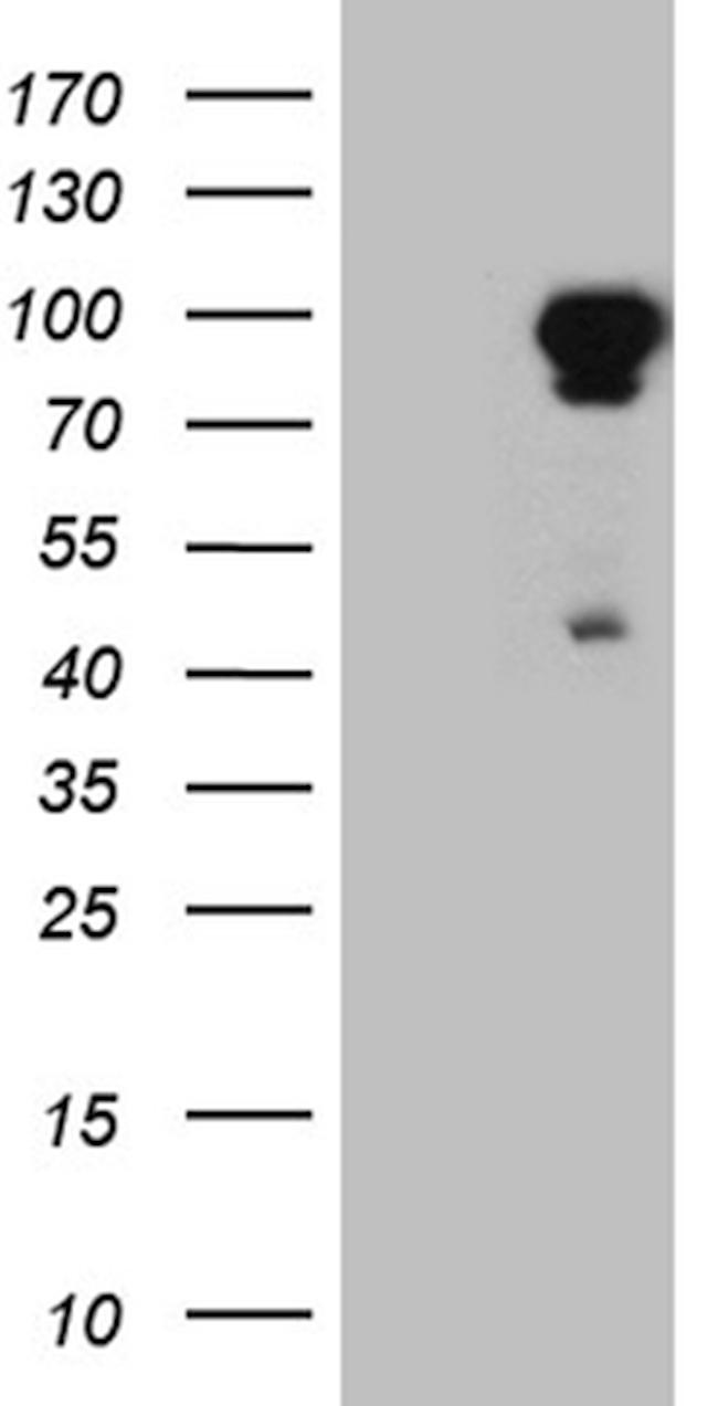 EEF1D Antibody in Western Blot (WB)