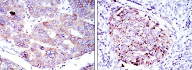 EEF2 Antibody in Immunohistochemistry (Paraffin) (IHC (P))