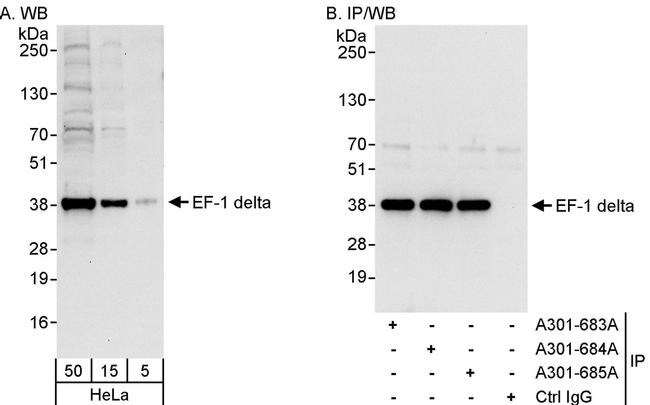 EF-1 delta Antibody in Western Blot (WB)