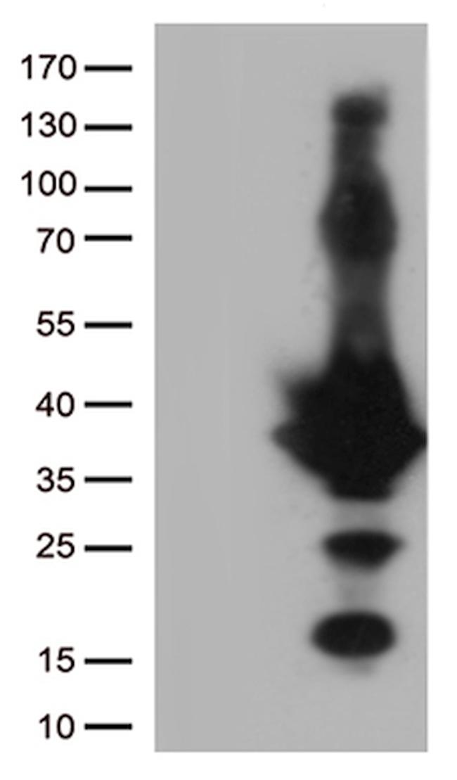 EFHD1 Antibody in Western Blot (WB)