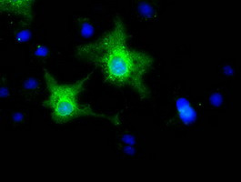 EFNA2 Antibody in Immunocytochemistry (ICC/IF)