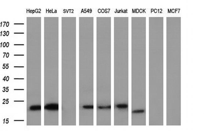 EFNA2 Antibody in Western Blot (WB)