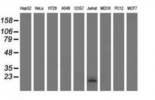 EFNA2 Antibody in Western Blot (WB)