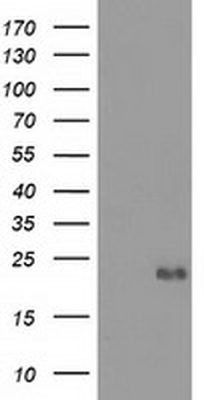 EFNA2 Antibody in Western Blot (WB)