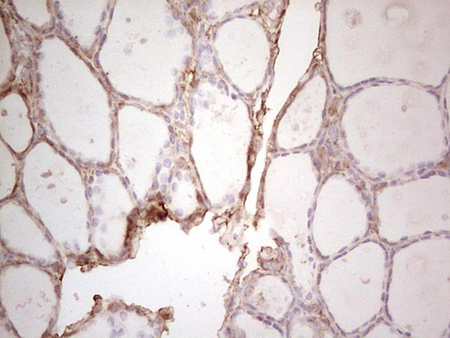 EFNA3 Antibody in Immunohistochemistry (Paraffin) (IHC (P))