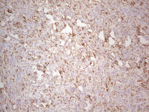 EFNA3 Antibody in Immunohistochemistry (Paraffin) (IHC (P))