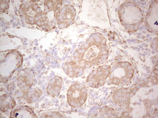 EFNA3 Antibody in Immunohistochemistry (Paraffin) (IHC (P))