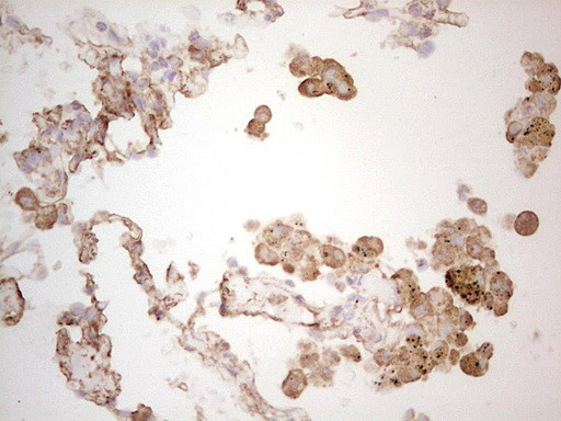 EFNA3 Antibody in Immunohistochemistry (Paraffin) (IHC (P))