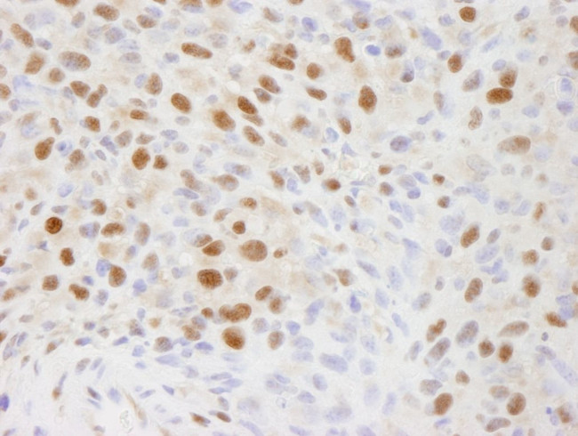 EFTUD2/SNRP116 Antibody in Immunohistochemistry (IHC)